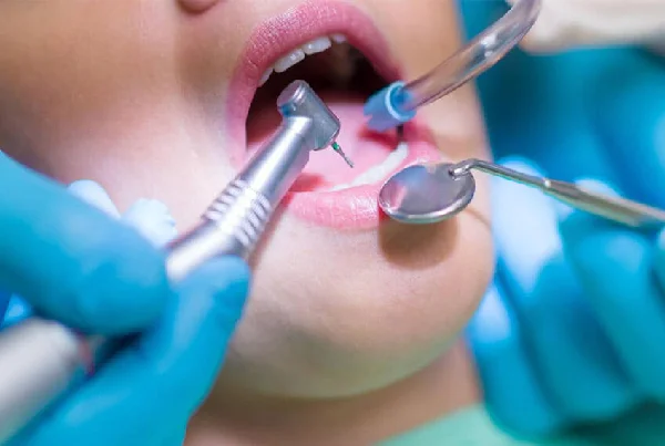 Oral Surgery Procedures